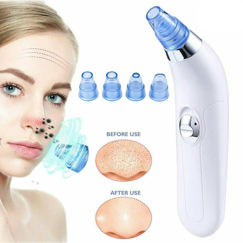 Unclog Pores Remove Blackheads Reveal Radiant Skin – All in Minutes