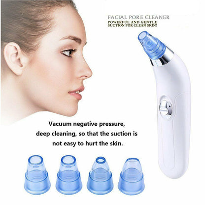 Unclog Pores Remove Blackheads Reveal Radiant Skin – All in Minutes